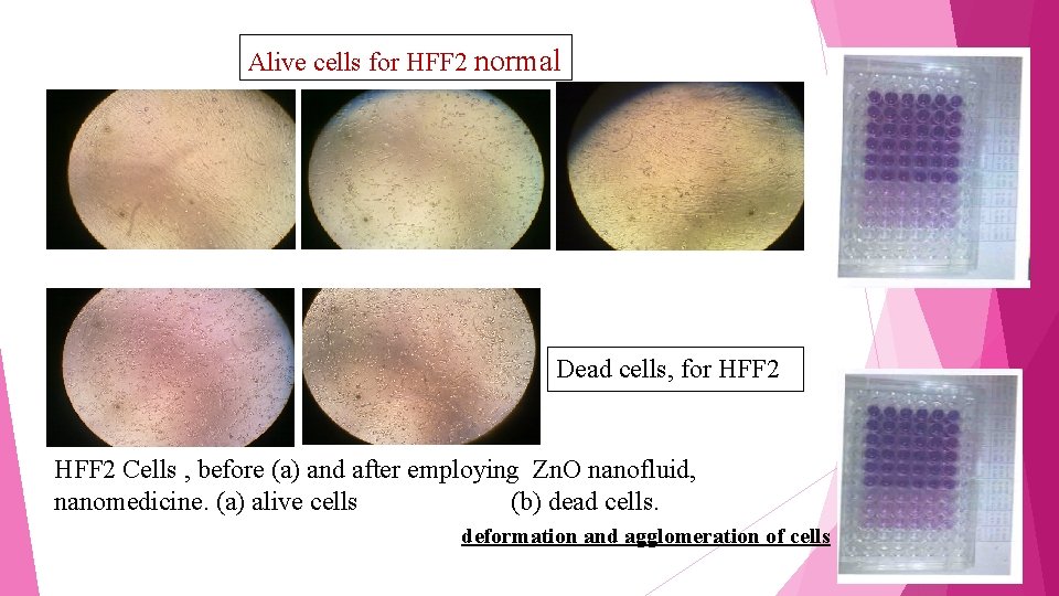 Alive cells for HFF 2 normal Dead cells, for HFF 2 Cells , before