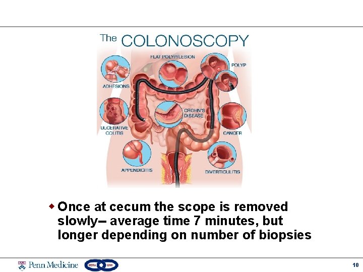 w Once at cecum the scope is removed slowly-- average time 7 minutes, but