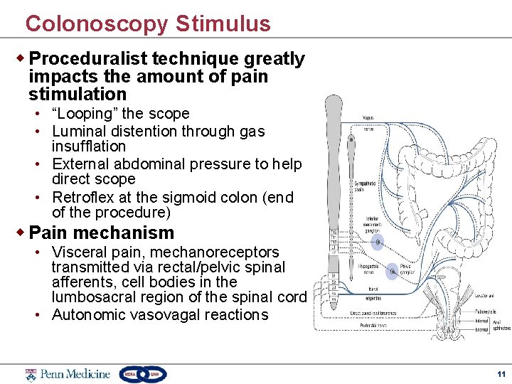Colonoscopy Stimulus w Proceduralist technique greatly impacts the amount of pain stimulation • “Looping”