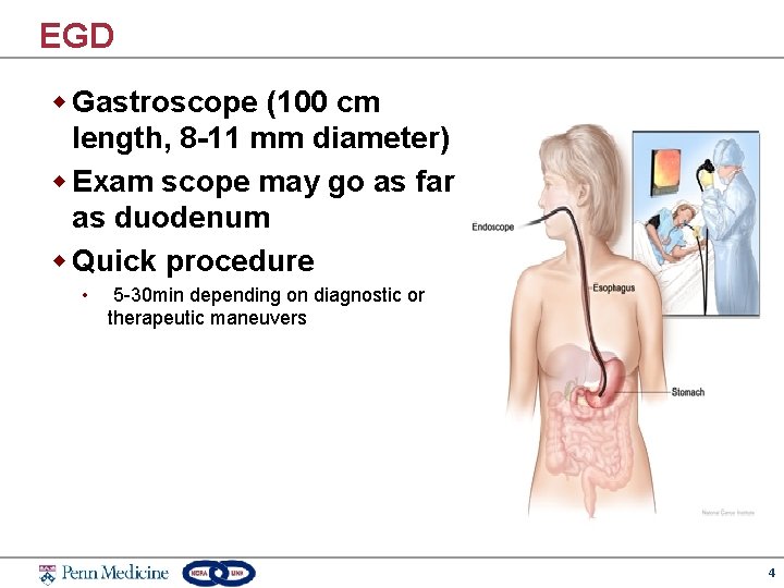 EGD w Gastroscope (100 cm length, 8 -11 mm diameter) w Exam scope may