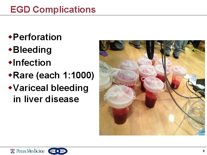 EGD Complications w. Perforation w. Bleeding w. Infection w. Rare (each 1: 1000) w.