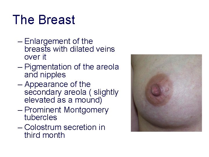The Breast – Enlargement of the breasts with dilated veins over it – Pigmentation The Breast – Enlargement of the breasts with dilated veins over it – Pigmentation