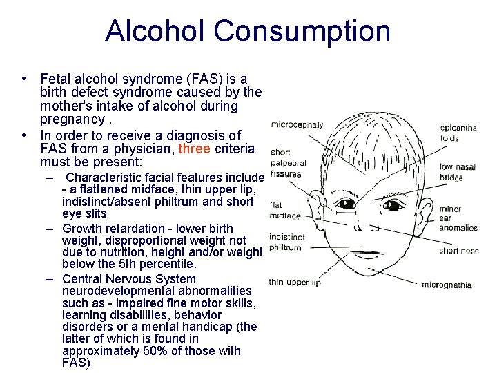 Alcohol Consumption • Fetal alcohol syndrome (FAS) is a birth defect syndrome caused by Alcohol Consumption • Fetal alcohol syndrome (FAS) is a birth defect syndrome caused by