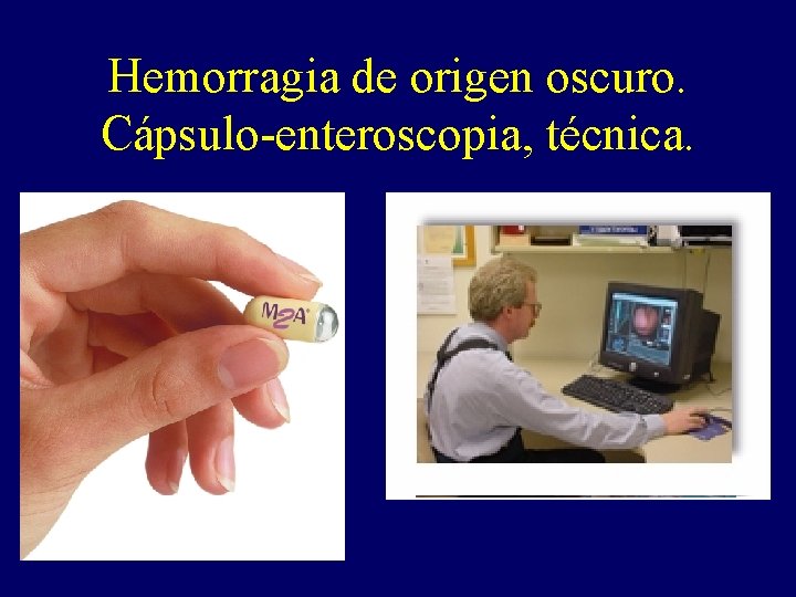 Hemorragia de origen oscuro. Cápsulo-enteroscopia, técnica. Hemorragia de origen oscuro. Cápsulo-enteroscopia, técnica.
