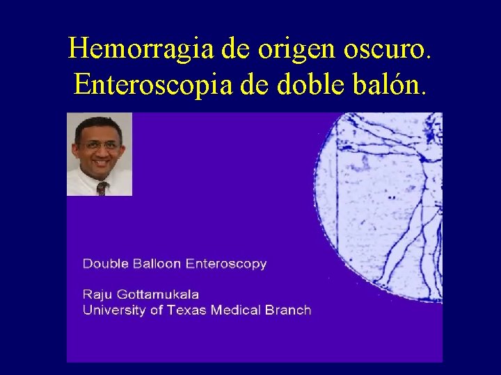 Hemorragia de origen oscuro. Enteroscopia de doble balón. Hemorragia de origen oscuro. Enteroscopia de doble balón.