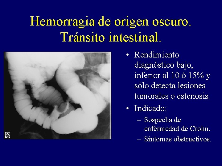 Hemorragia de origen oscuro. Tránsito intestinal. • Rendimiento diagnóstico bajo, inferior al 10 ó Hemorragia de origen oscuro. Tránsito intestinal. • Rendimiento diagnóstico bajo, inferior al 10 ó
