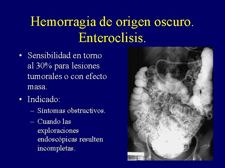 Hemorragia de origen oscuro. Enteroclisis. • Sensibilidad en torno al 30% para lesiones tumorales Hemorragia de origen oscuro. Enteroclisis. • Sensibilidad en torno al 30% para lesiones tumorales