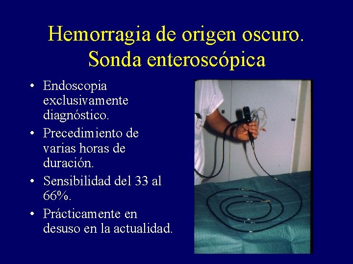 Hemorragia de origen oscuro. Sonda enteroscópica • Endoscopia exclusivamente diagnóstico. • Precedimiento de varias Hemorragia de origen oscuro. Sonda enteroscópica • Endoscopia exclusivamente diagnóstico. • Precedimiento de varias