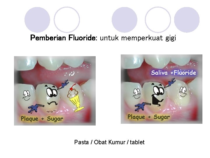 Pemberian Fluoride: untuk memperkuat gigi Pasta / Obat Kumur / tablet 