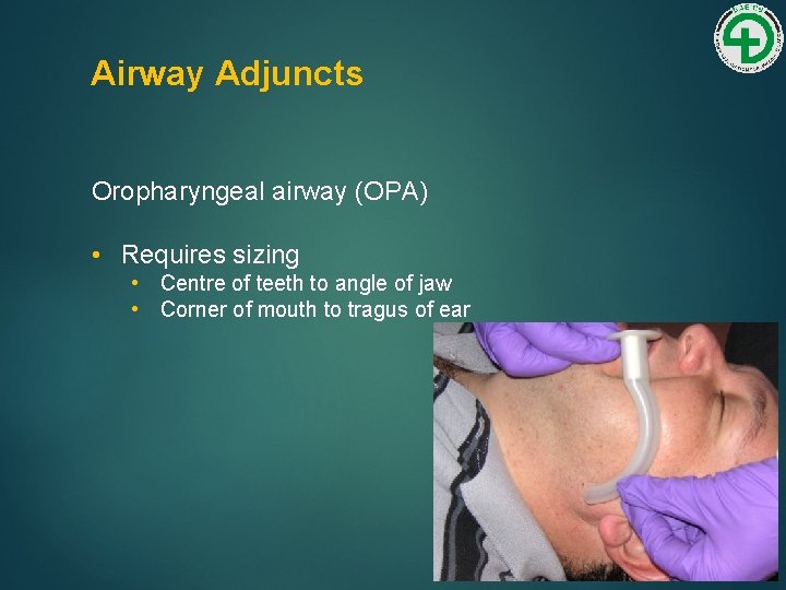 Airway Adjuncts Oropharyngeal airway (OPA) • Requires sizing • Centre of teeth to angle