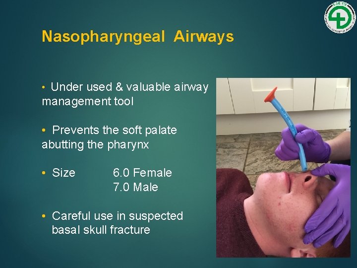 Nasopharyngeal Airways • Under used & valuable airway management tool • Prevents the soft