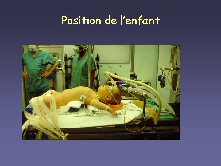 Position de l’enfant 