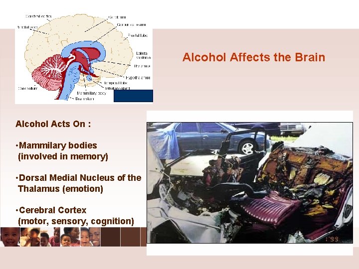 Alcohol Affects the Brain Alcohol Acts On : • Mammilary bodies (involved in memory) Alcohol Affects the Brain Alcohol Acts On : • Mammilary bodies (involved in memory)