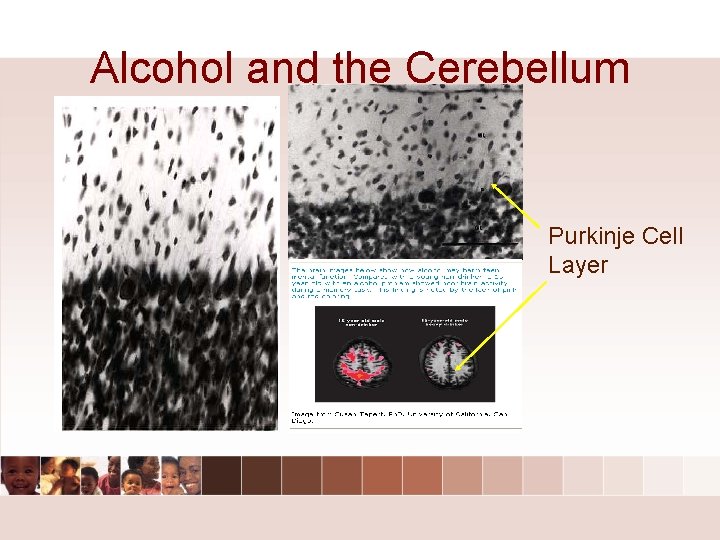 Alcohol and the Cerebellum Purkinje Cell Layer Alcohol and the Cerebellum Purkinje Cell Layer