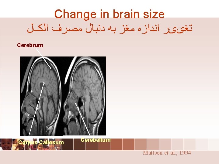 Change in brain size ﺗﻐییﺮ ﺍﻧﺪﺍﺯﻩ ﻣﻐﺰ ﺑﻪ ﺩﻧﺒﺎﻝ ﻣﺼﺮﻑ ﺍﻟکﻞ Cerebrum Corpus Callosum Change in brain size ﺗﻐییﺮ ﺍﻧﺪﺍﺯﻩ ﻣﻐﺰ ﺑﻪ ﺩﻧﺒﺎﻝ ﻣﺼﺮﻑ ﺍﻟکﻞ Cerebrum Corpus Callosum