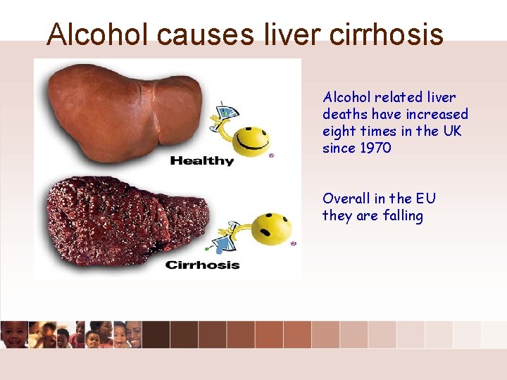 Alcohol causes liver cirrhosis Alcohol related liver deaths have increased eight times in the Alcohol causes liver cirrhosis Alcohol related liver deaths have increased eight times in the