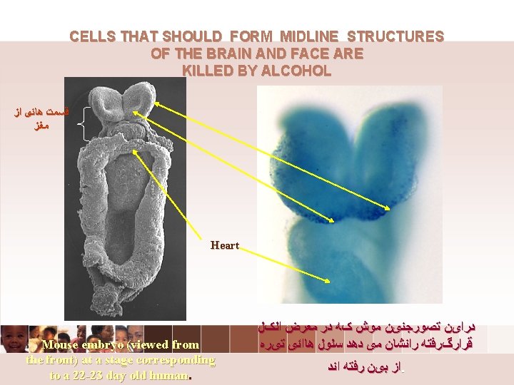 6 CELLS THAT SHOULD FORM MIDLINE STRUCTURES OF THE BRAIN AND FACE ARE KILLED 6 CELLS THAT SHOULD FORM MIDLINE STRUCTURES OF THE BRAIN AND FACE ARE KILLED