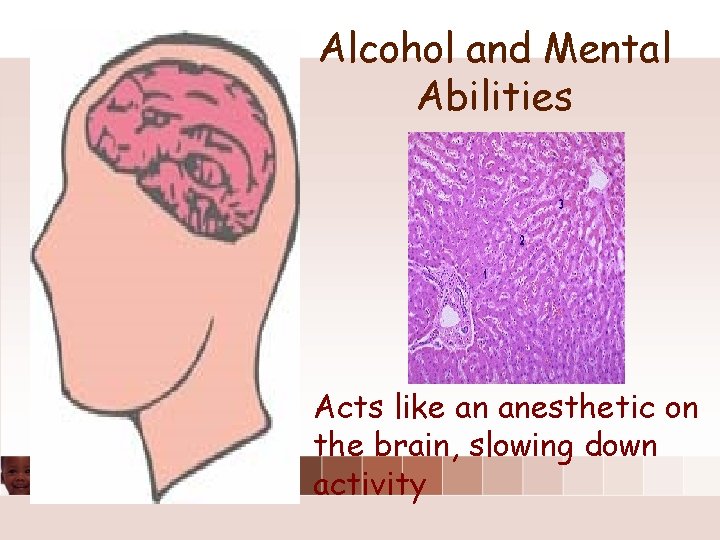 Alcohol and Mental Abilities Acts like an anesthetic on the brain, slowing down activity Alcohol and Mental Abilities Acts like an anesthetic on the brain, slowing down activity