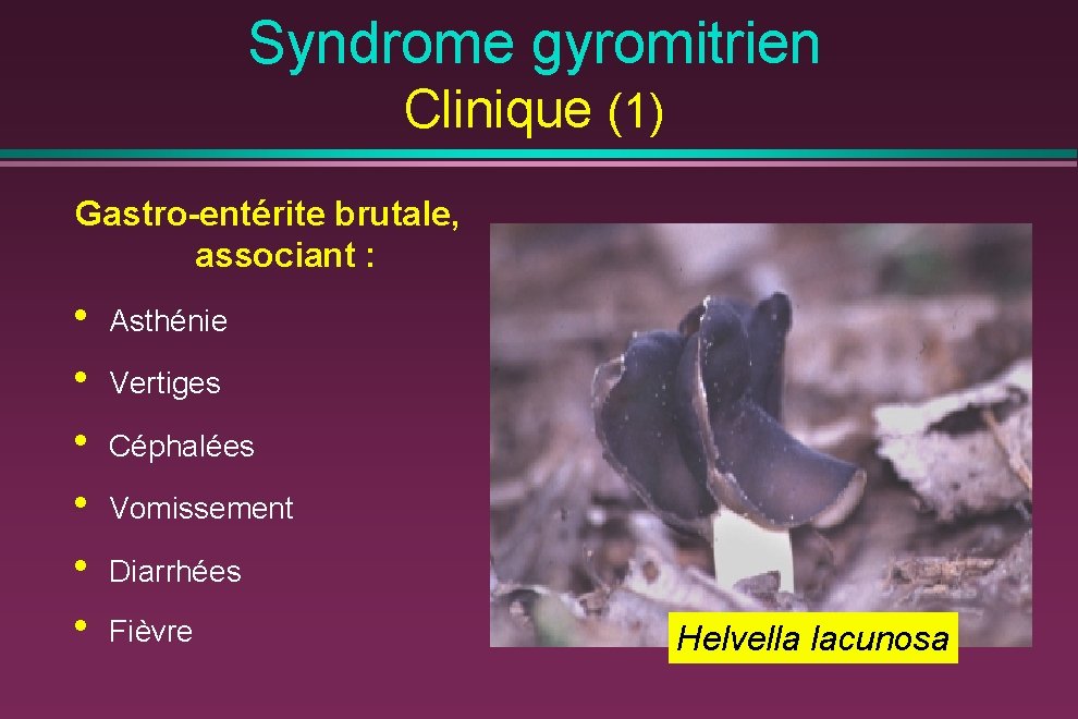 Syndrome gyromitrien Clinique (1) Gastro-entérite brutale, associant : • • • Asthénie Vertiges Céphalées