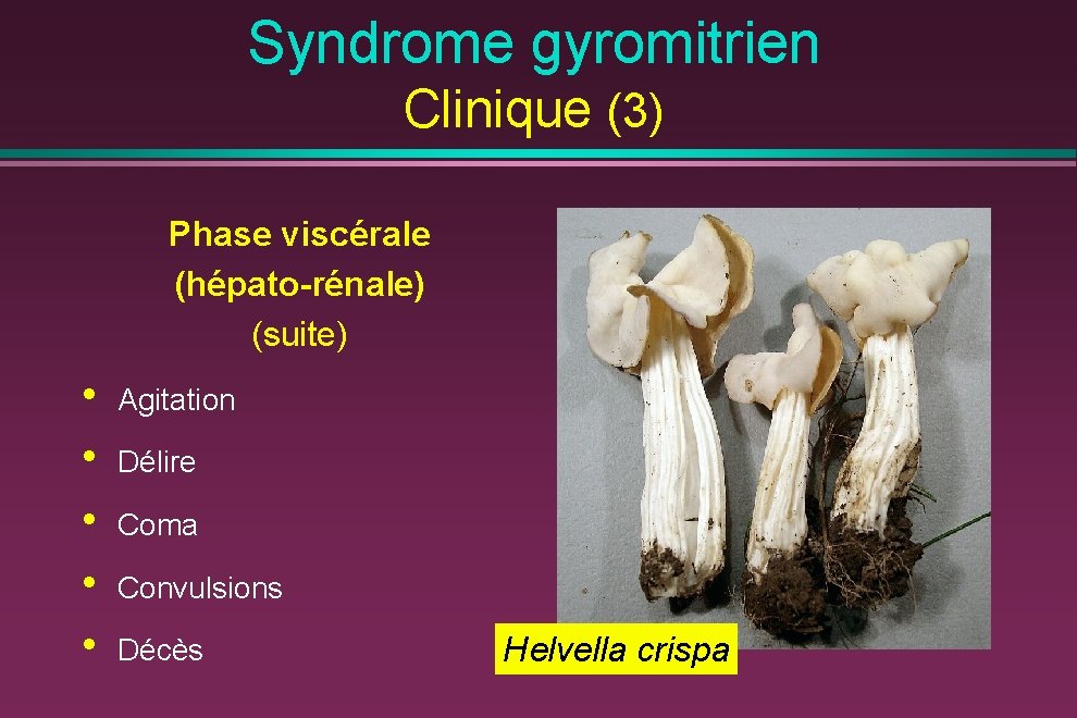 Syndrome gyromitrien Clinique (3) Phase viscérale (hépato-rénale) (suite) • • • Agitation Délire Coma