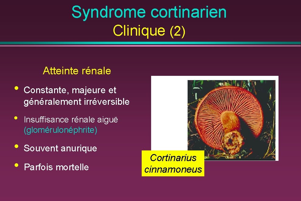 Syndrome cortinarien Clinique (2) Atteinte rénale • • Constante, majeure et généralement irréversible Insuffisance