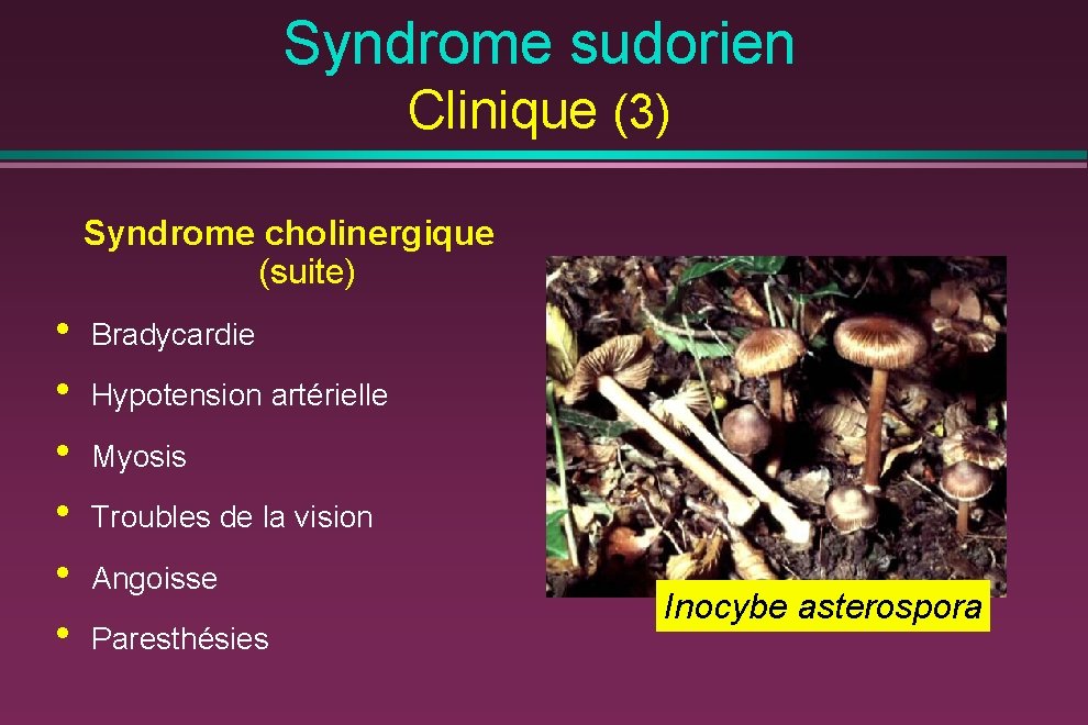 Syndrome sudorien Clinique (3) Syndrome cholinergique (suite) • • • Bradycardie Hypotension artérielle Myosis