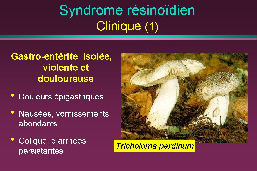Syndrome résinoïdien Clinique (1) Gastro-entérite isolée, violente et douloureuse • • Douleurs épigastriques •