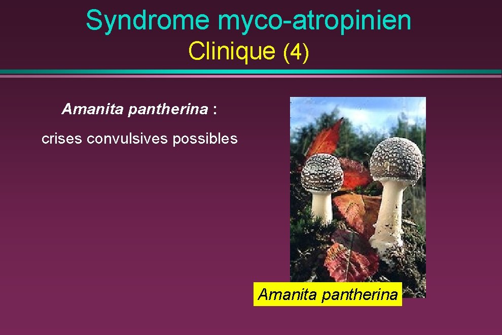 Syndrome myco-atropinien Clinique (4) Amanita pantherina : crises convulsives possibles Amanita pantherina 