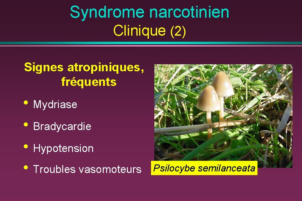 Syndrome narcotinien Clinique (2) Signes atropiniques, fréquents • Mydriase • Bradycardie • Hypotension •