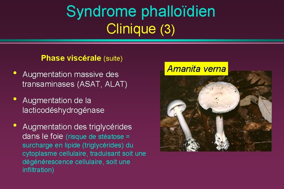 Syndrome phalloïdien Clinique (3) Phase viscérale (suite) • Augmentation massive des transaminases (ASAT, ALAT)