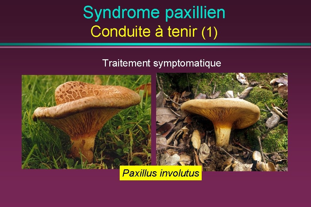 Syndrome paxillien Conduite à tenir (1) Traitement symptomatique Paxillus involutus 