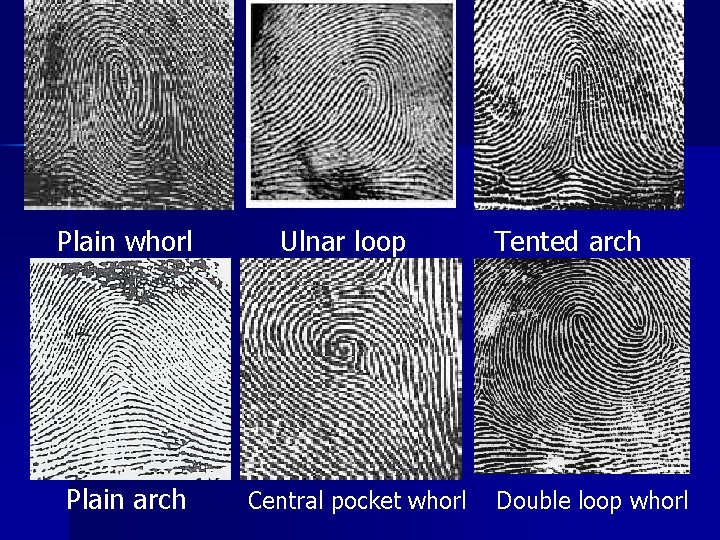  Plain whorl Ulnar loop Tented arch Plain arch Central pocket whorl Double loop