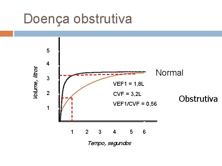 Doença obstrutiva Volume, litros 5 4 Normal 3 VEF 1 = 1, 8 L Doença obstrutiva Volume, litros 5 4 Normal 3 VEF 1 = 1, 8 L