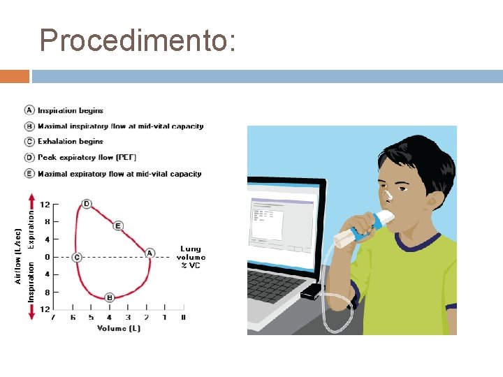 Procedimento: Procedimento: