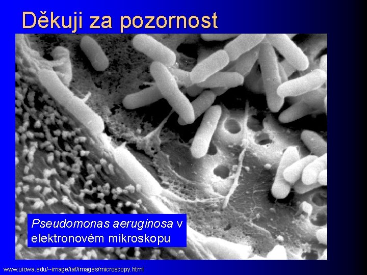 Děkuji za pozornost Pseudomonas aeruginosa v elektronovém mikroskopu www. uiowa. edu/~image/iaf/images/microscopy. html 