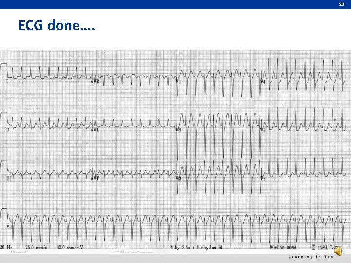 23 ECG done…. 
