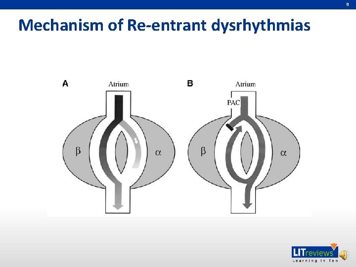 8 Mechanism of Re-entrant dysrhythmias 