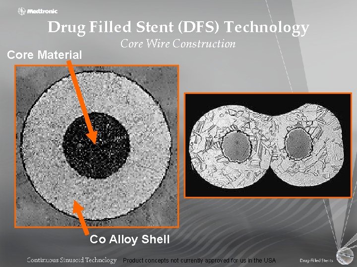 Drug Filled Stent (DFS) Technology Core Material Core Wire Construction Co Alloy Shell Product