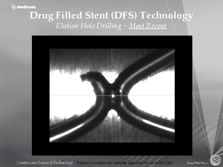 Drug Filled Stent (DFS) Technology Elution Hole Drilling – Most Recent Product concepts not