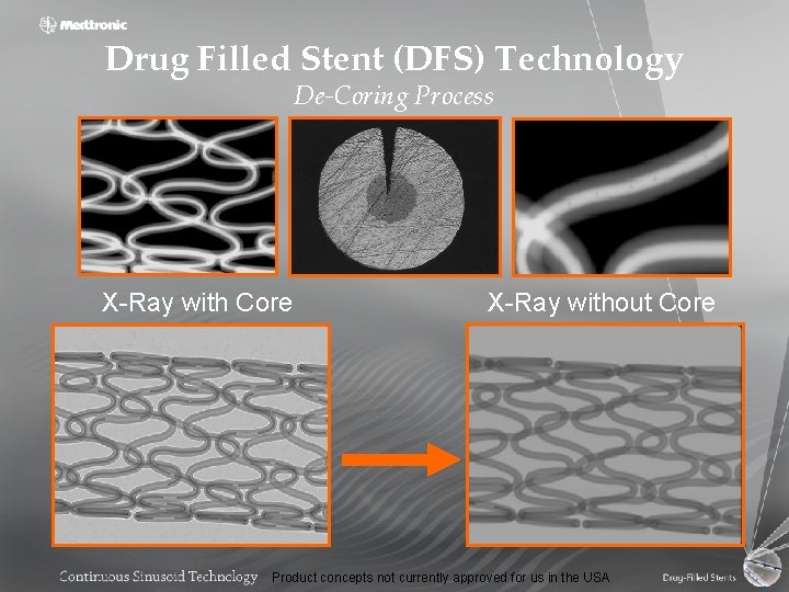 Drug Filled Stent (DFS) Technology De-Coring Process X-Ray with Core X-Ray without Core Product