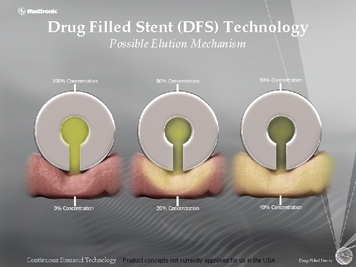 Drug Filled Stent (DFS) Technology Possible Elution Mechanism Product concepts not currently approved for