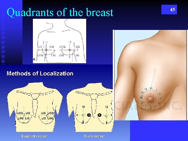 Quadrants of the breast 45 