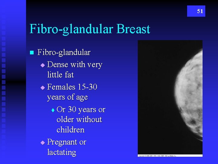 51 Fibro-glandular Breast n Fibro-glandular u Dense with very little fat u Females 15