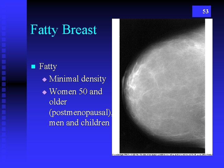 53 Fatty Breast n Fatty u Minimal density u Women 50 and older (postmenopausal),