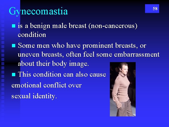 Gynecomastia 58 is a benign male breast (non-cancerous) condition n Some men who have