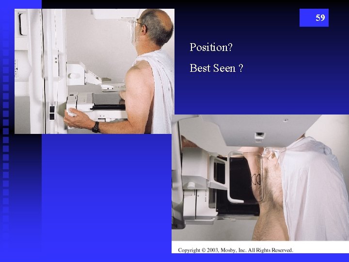 59 Position? Best Seen ? 