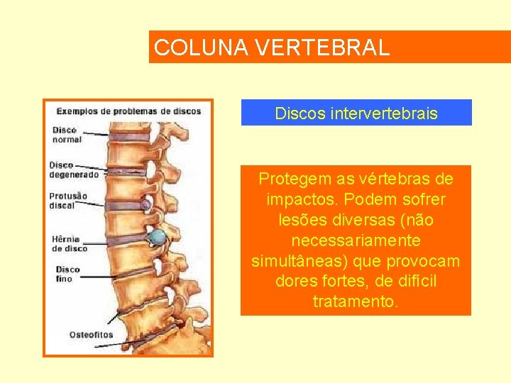 COLUNA VERTEBRAL Discos intervertebrais Protegem as vértebras de impactos. Podem sofrer lesões diversas (não