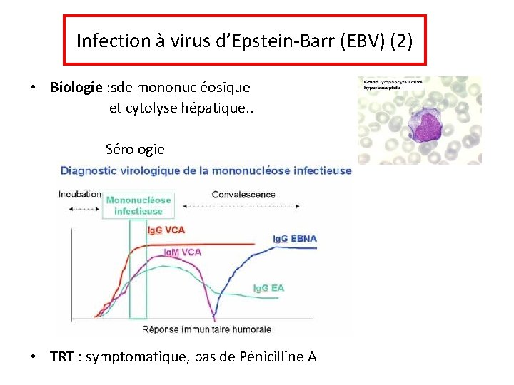 Infection à virus d’Epstein-Barr (EBV) (2) • Biologie : sde mononucléosique et cytolyse hépatique.