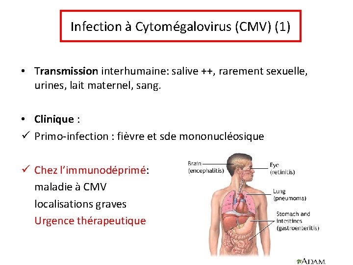 Infection à Cytomégalovirus (CMV) (1) • Transmission interhumaine: salive ++, rarement sexuelle, urines, lait