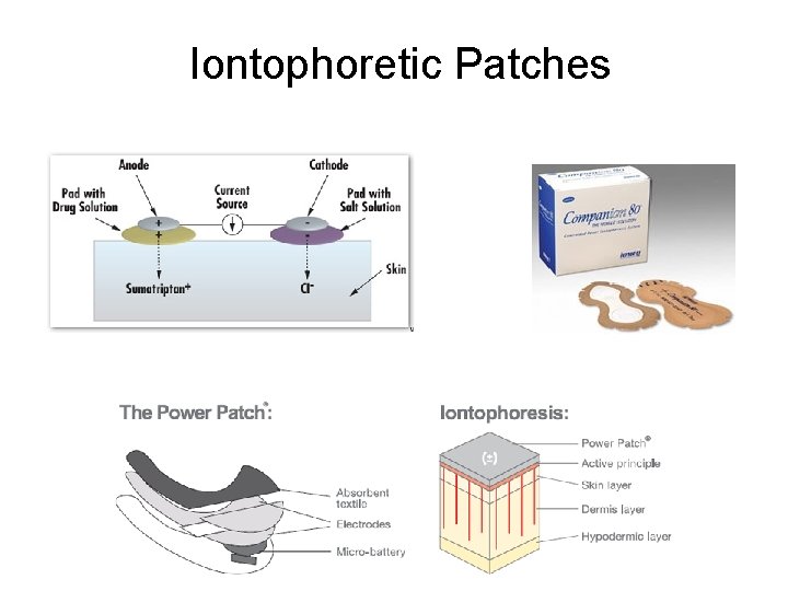 Iontophoretic Patches 